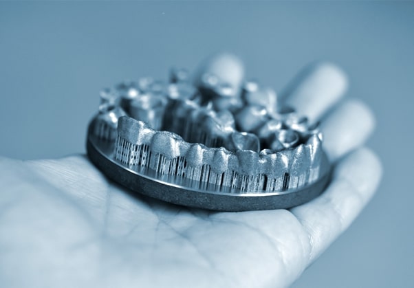 metal 3d printing dental implants